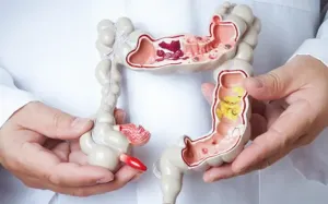 Mide ve Barsak Hastalıkları Nelerdir?